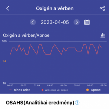 Aberto F22R okosóra - Fekete, Cserélhető Fekete szilikon szíjjal