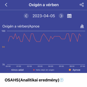  Aberto F22R okosóra - Fekete, Cserélhető Fekete Milánói fémszíjjal