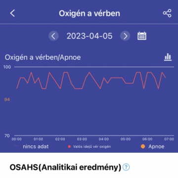 Aberto F22R okosóra - Fekete, Cserélhető Fekete Csatos fémszíjjal